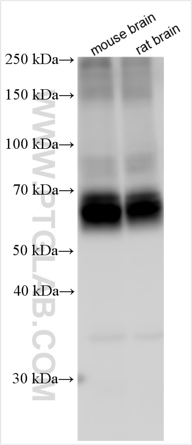 Western Blot (WB) analysis of various lysates using EAAT2 Polyclonal antibody (22515-1-AP)