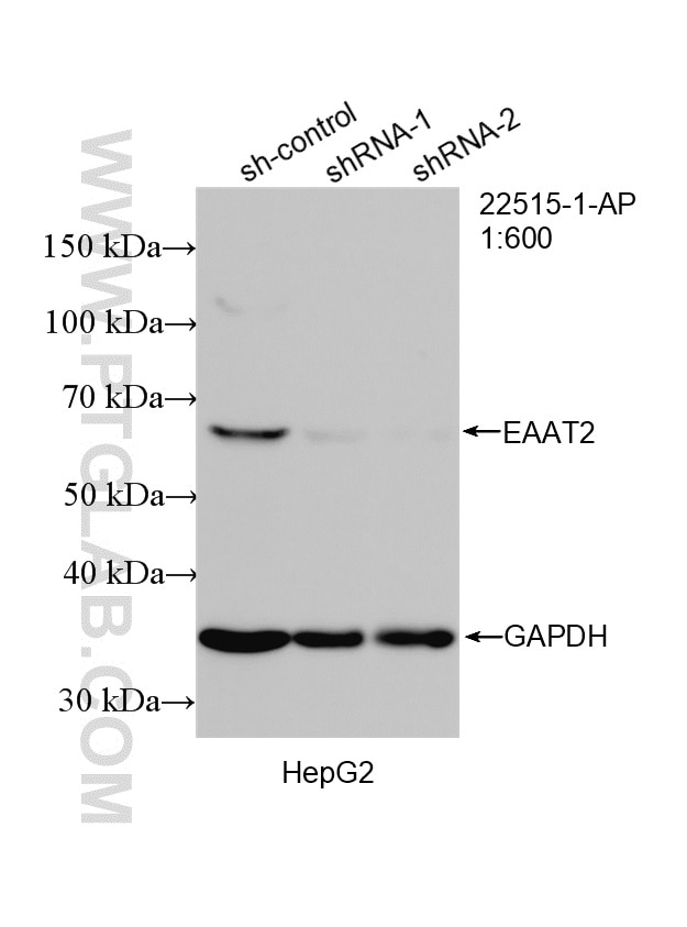 Western Blot (WB) analysis of HepG2 cells using EAAT2 Polyclonal antibody (22515-1-AP)