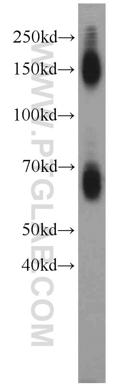 Western Blot (WB) analysis of mouse brain tissue using EAAT2 Polyclonal antibody (22515-1-AP)