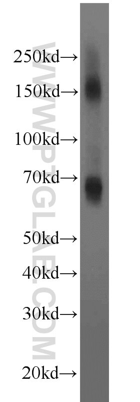 Western Blot (WB) analysis of rat brain tissue using EAAT2 Polyclonal antibody (22515-1-AP)