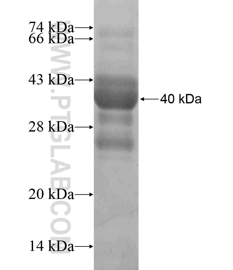 SLC1A2 fusion protein Ag18247 SDS-PAGE