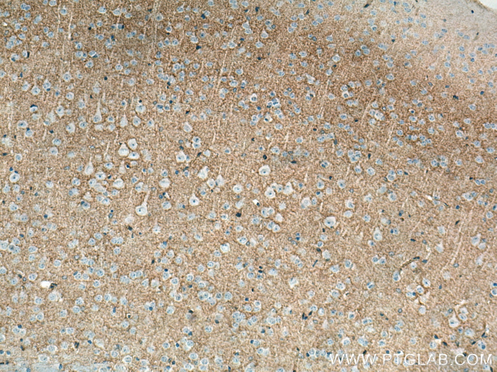 Immunohistochemistry (IHC) staining of mouse brain tissue using SLC1A4 Polyclonal antibody (13067-2-AP)