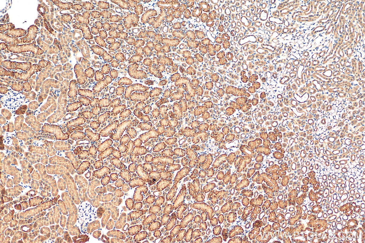 IHC staining of mouse kidney using 13067-2-AP