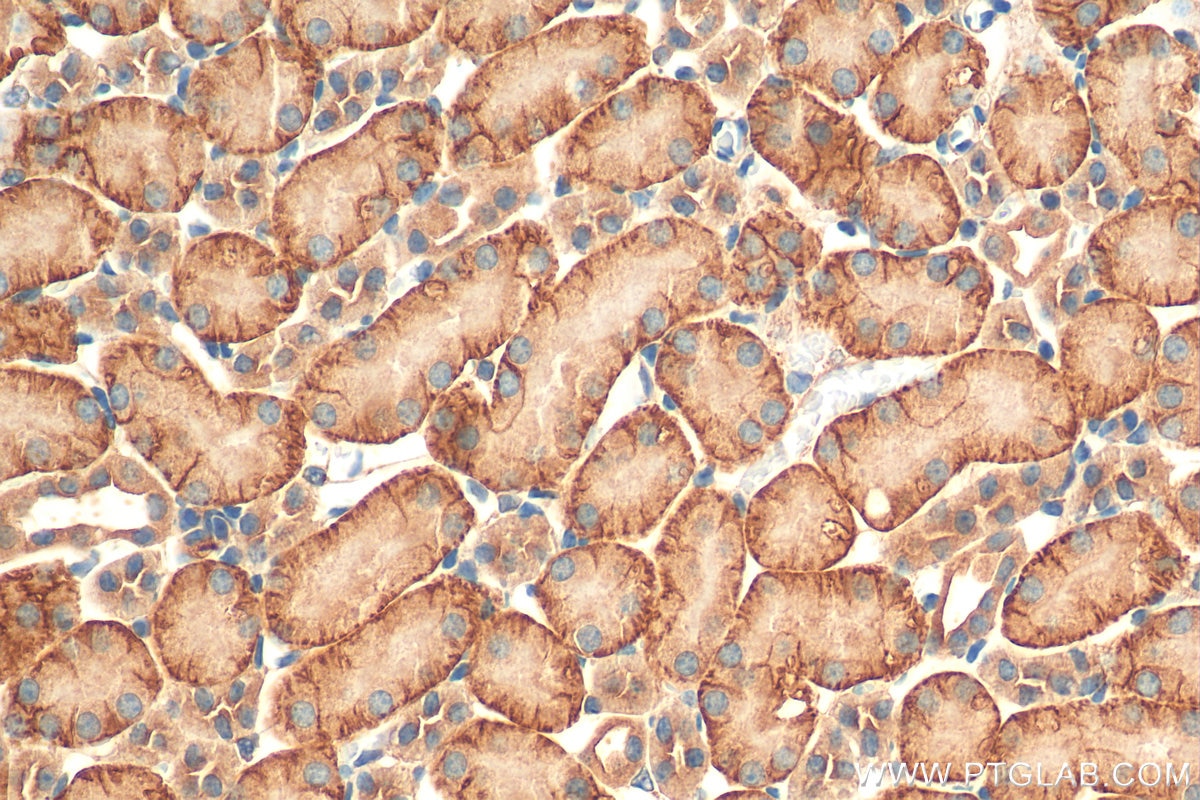 Immunohistochemistry (IHC) staining of mouse kidney tissue using SLC1A4 Polyclonal antibody (13067-2-AP)