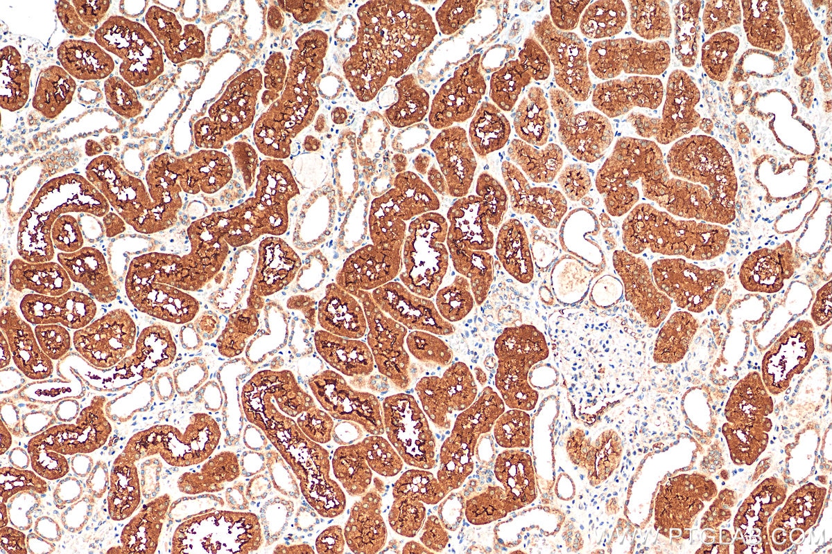 IHC staining of human kidney using 13067-2-AP