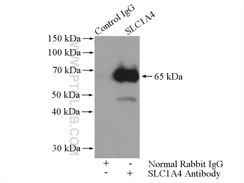 Immunoprecipitation (IP) experiment of mouse brain tissue using SLC1A4 Polyclonal antibody (13067-2-AP)