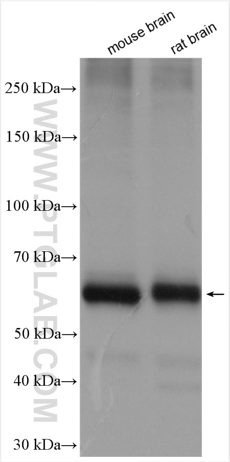Western Blot (WB) analysis of various lysates using SLC1A4 Polyclonal antibody (13067-2-AP)