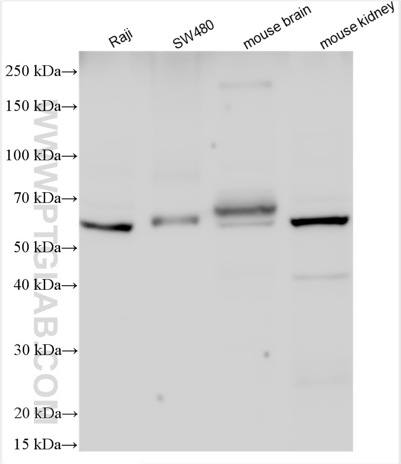 Western Blot (WB) analysis of various lysates using SLC1A4 Polyclonal antibody (13067-2-AP)
