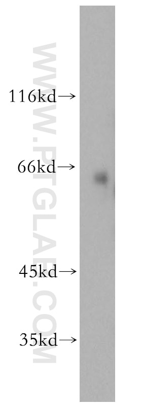 Western Blot (WB) analysis of human skeletal muscle tissue using SLC1A4 Polyclonal antibody (13067-2-AP)