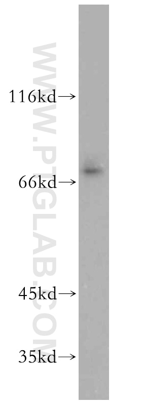 Western Blot (WB) analysis of A375 cells using EAAT4 Polyclonal antibody (12876-1-AP)