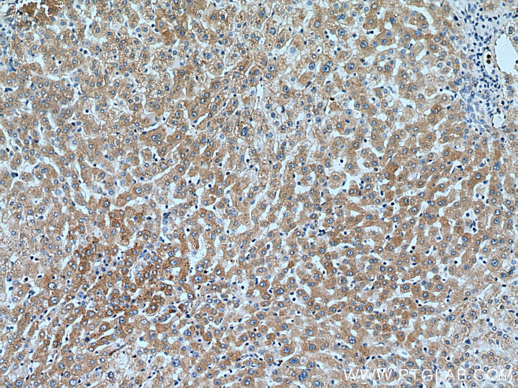 Immunohistochemistry (IHC) staining of human liver tissue using SLC20A1 Polyclonal antibody (12423-1-AP)