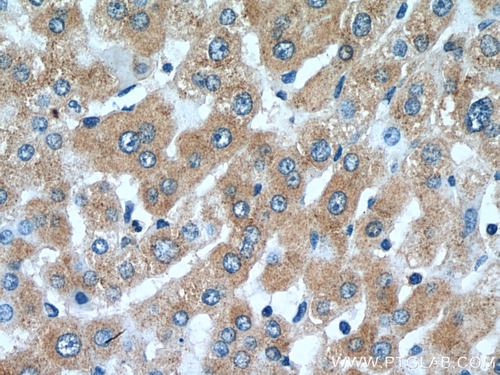 Immunohistochemistry (IHC) staining of human liver tissue using SLC20A1 Polyclonal antibody (12423-1-AP)