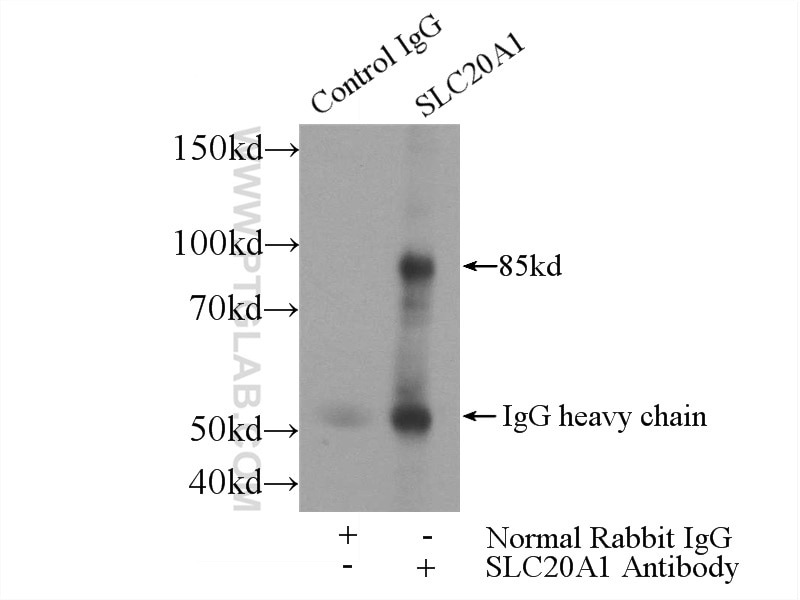 Immunoprecipitation (IP) experiment of HEK-293 cells using SLC20A1 Polyclonal antibody (12423-1-AP)