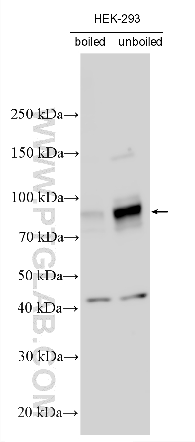 Western Blot (WB) analysis of various lysates using SLC20A1 Polyclonal antibody (12423-1-AP)
