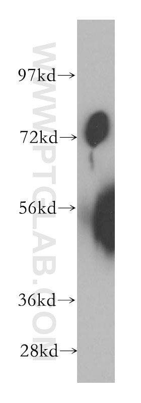 Western Blot (WB) analysis of K-562 cells using SLC20A1 Polyclonal antibody (12423-1-AP)