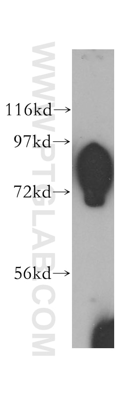 Western Blot (WB) analysis of Jurkat cells using SLC20A1 Polyclonal antibody (12423-1-AP)