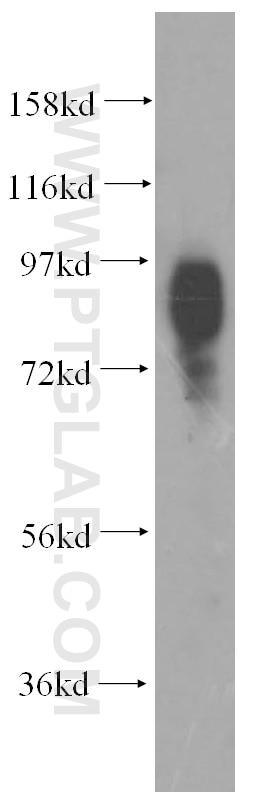 Western Blot (WB) analysis of HEK-293 cells using SLC20A1 Polyclonal antibody (12423-1-AP)