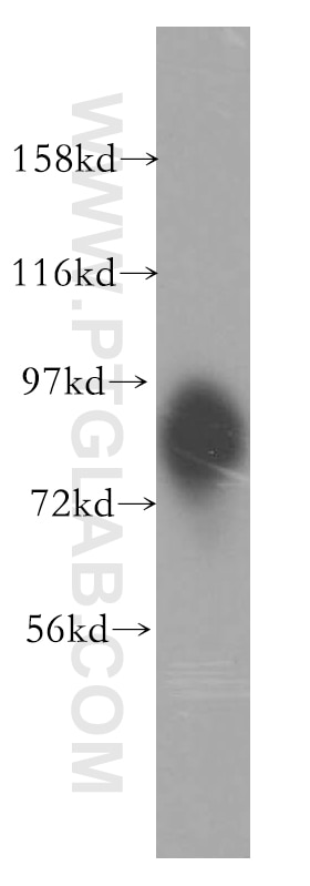 Western Blot (WB) analysis of HeLa cells using SLC20A1 Polyclonal antibody (12423-1-AP)