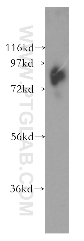 Western Blot (WB) analysis of human kidney tissue using SLC20A1 Polyclonal antibody (12423-1-AP)