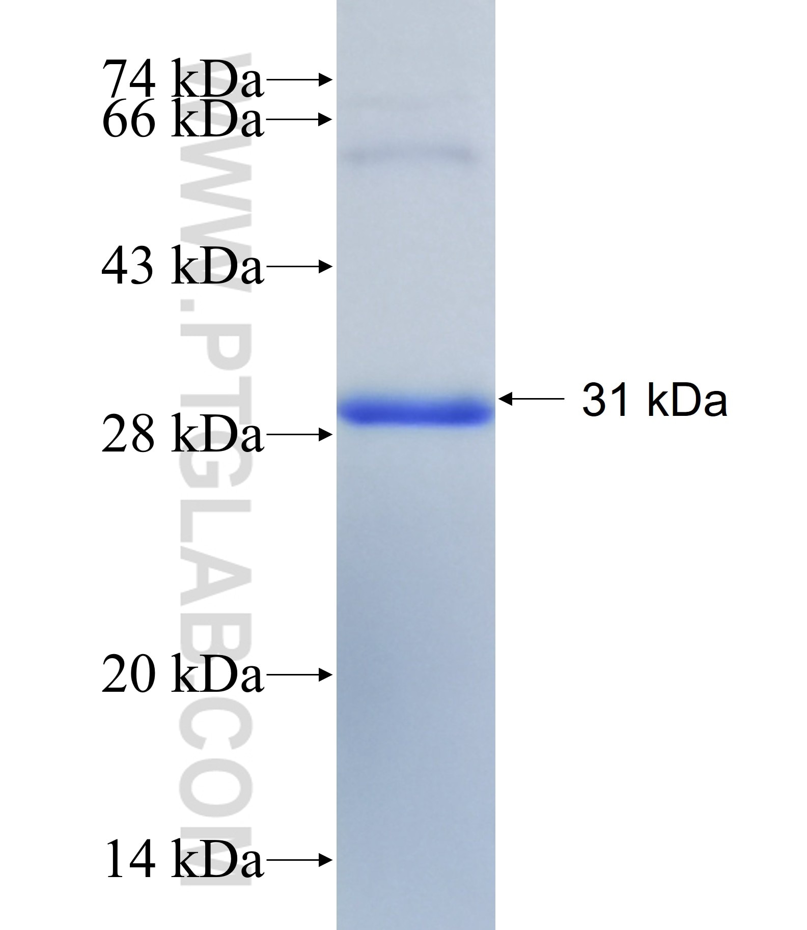 SLC20A1 fusion protein Ag31488 SDS-PAGE SLC20A1 fusion protein Ag31488 SDS-PAGE