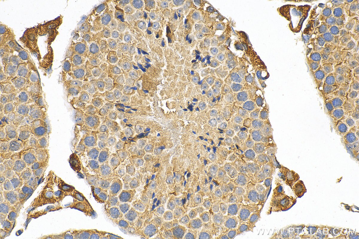 Immunohistochemistry (IHC) staining of mouse testis tissue using SLC20A2 Polyclonal antibody (12820-1-AP)