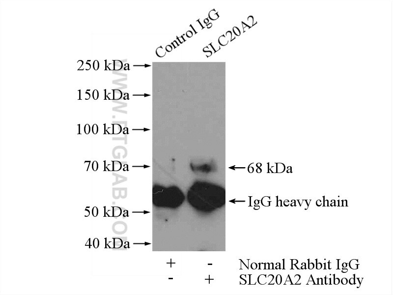 Immunoprecipitation (IP) experiment of COLO 320 cells using SLC20A2 Polyclonal antibody (12820-1-AP)