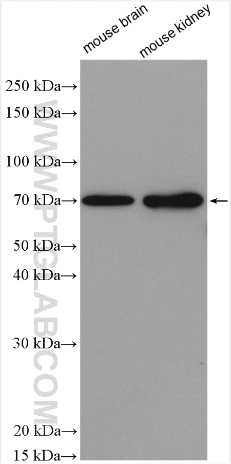 Western Blot (WB) analysis of various lysates using SLC20A2 Polyclonal antibody (12820-1-AP)