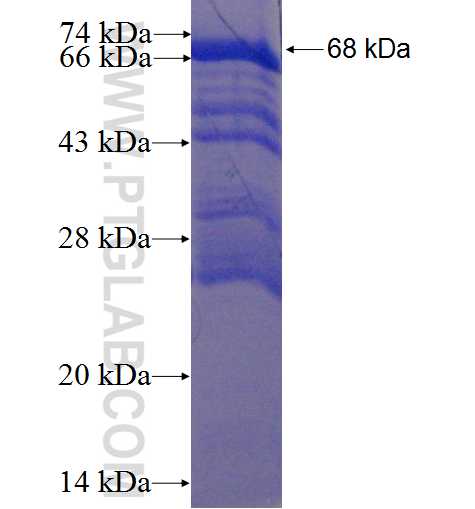 SLC20A2 fusion protein Ag3469 SDS-PAGE