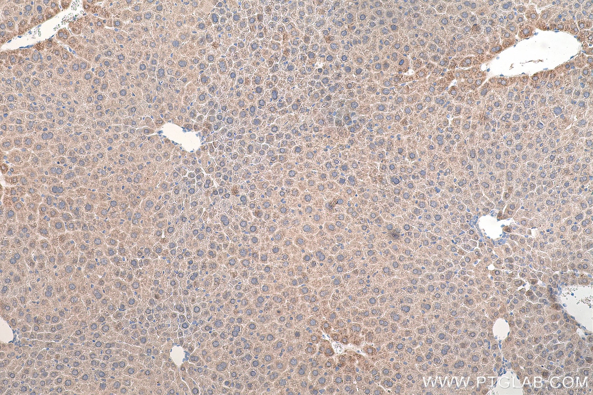 Immunohistochemistry (IHC) staining of mouse liver tissue using SLC22A1 Polyclonal antibody (24617-1-AP)