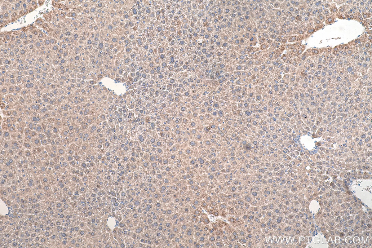 IHC staining of mouse liver using 24617-1-AP