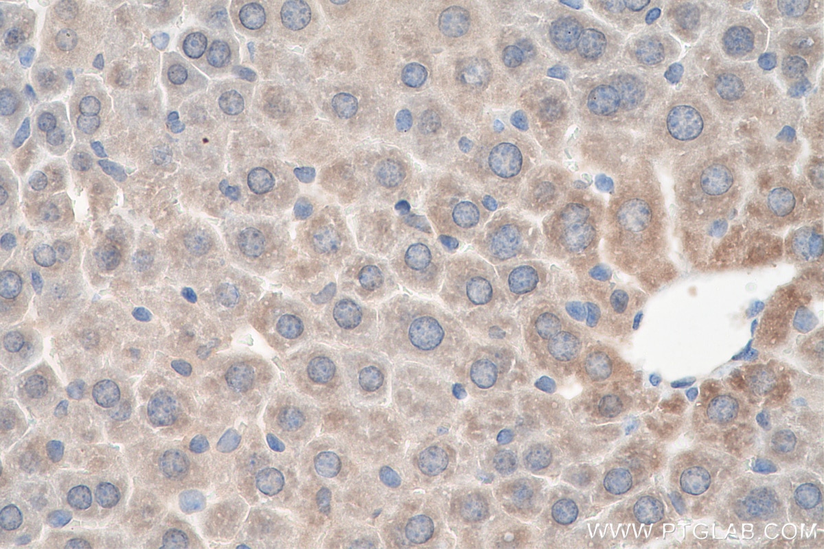 Immunohistochemistry (IHC) staining of mouse liver tissue using SLC22A1 Polyclonal antibody (24617-1-AP)