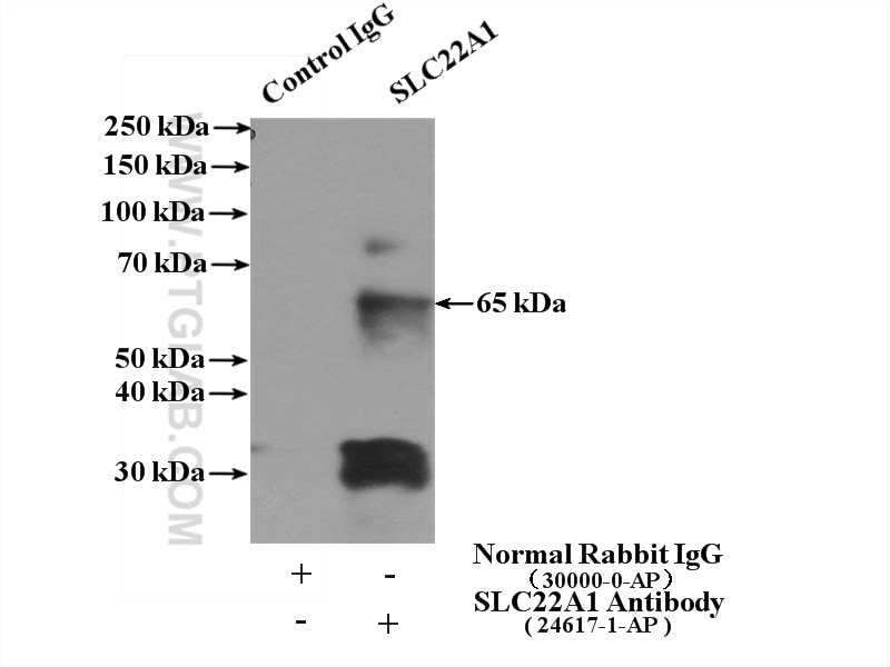 Immunoprecipitation (IP) experiment of mouse liver tissue using SLC22A1 Polyclonal antibody (24617-1-AP)