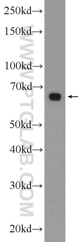 Western Blot (WB) analysis of mouse liver tissue using SLC22A1 Polyclonal antibody (24617-1-AP)