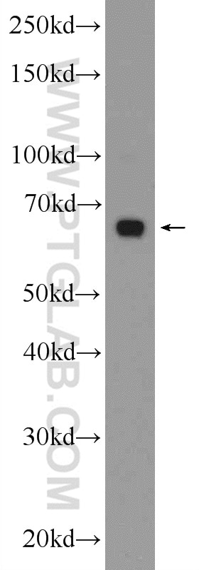 WB analysis of mouse liver using 24617-1-AP