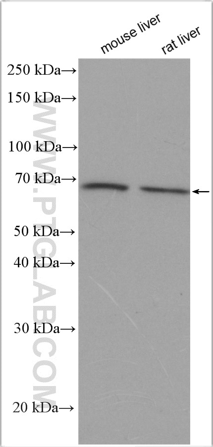 Western Blot (WB) analysis of various lysates using SLC22A1 Polyclonal antibody (24617-1-AP)
