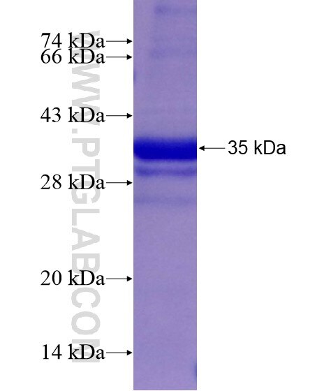 SLC22A1 fusion protein Ag18806 SDS-PAGE