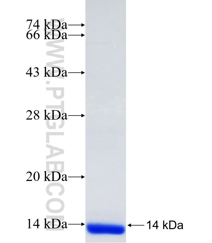 SLC22A10 fusion protein Ag34558 SDS-PAGE SLC22A10 fusion protein Ag34558 SDS-PAGE