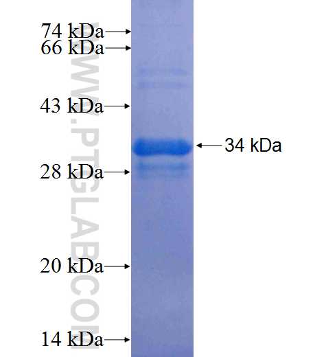 SLC22A11 fusion protein Ag25215 SDS-PAGE
