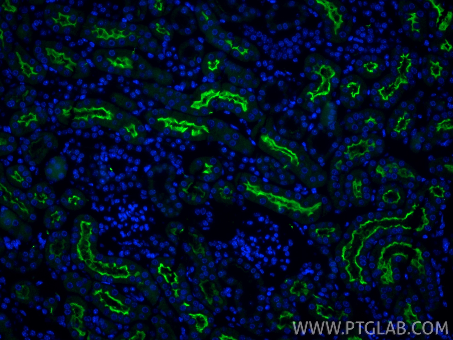 IF Staining of mouse kidney using 14937-1-AP Immunofluorescence (IF) / fluorescent staining of mouse kidney tissue using URAT1 Polyclonal antibody (14937-1-AP)