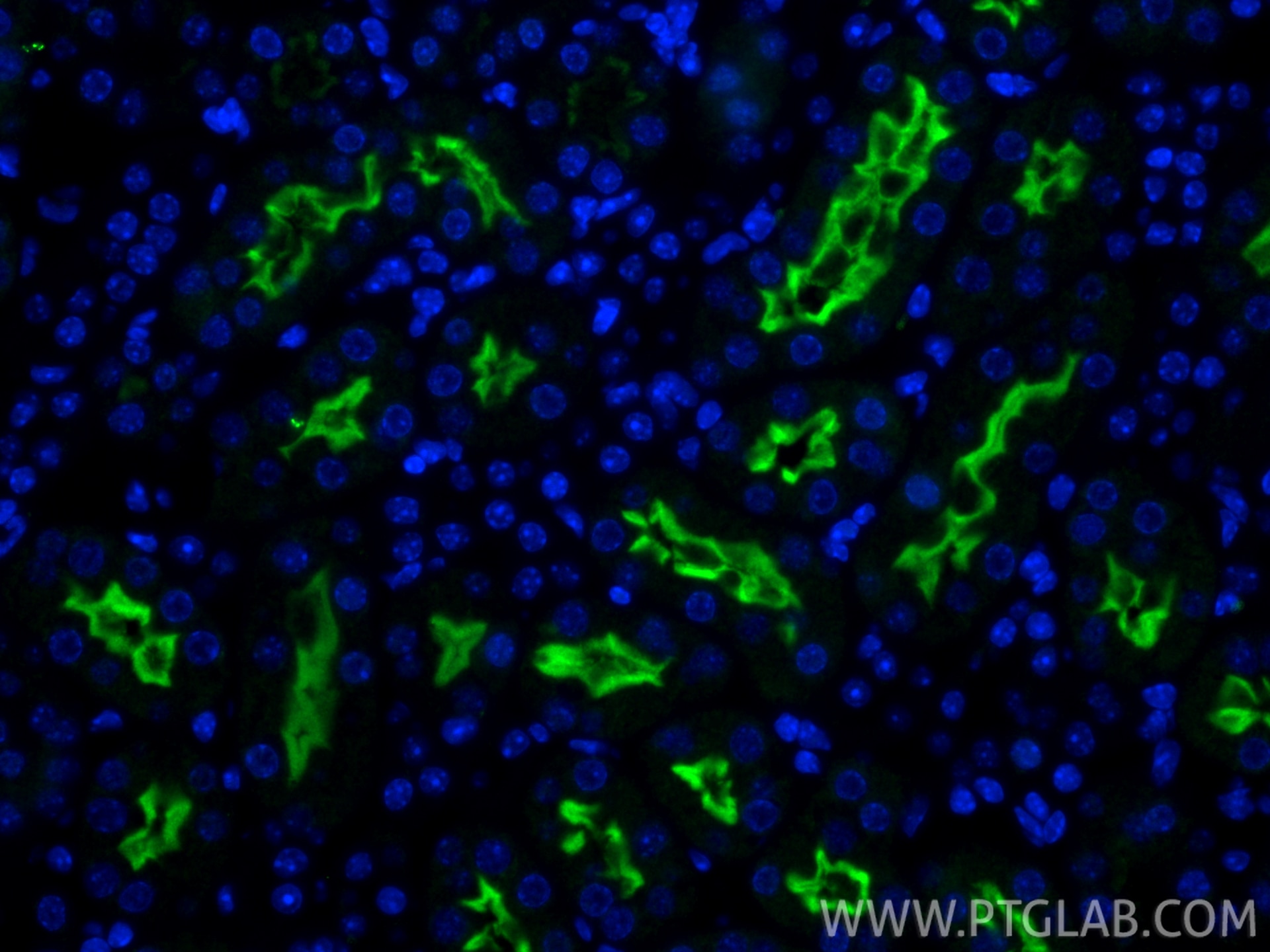 IF Staining of mouse kidney using 14937-1-AP Immunofluorescence (IF) / fluorescent staining of mouse kidney tissue using URAT1 Polyclonal antibody (14937-1-AP)