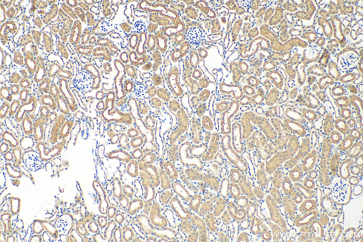 Immunohistochemistry (IHC) staining of mouse kidney tissue using URAT1 Polyclonal antibody (14937-1-AP)