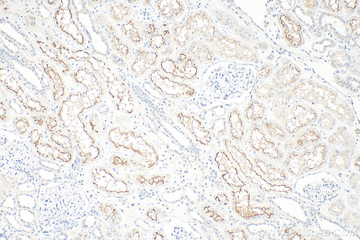 Immunohistochemistry (IHC) staining of human kidney tissue using URAT1 Polyclonal antibody (14937-1-AP)