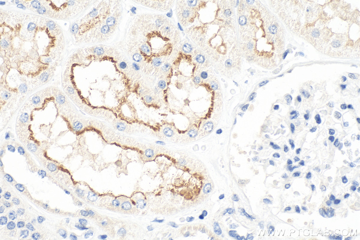 Immunohistochemistry (IHC) staining of human kidney tissue using URAT1 Polyclonal antibody (14937-1-AP)