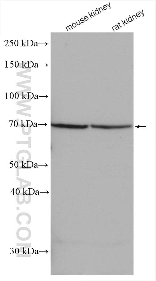 Western Blot (WB) analysis of various lysates using URAT1 Polyclonal antibody (14937-1-AP)