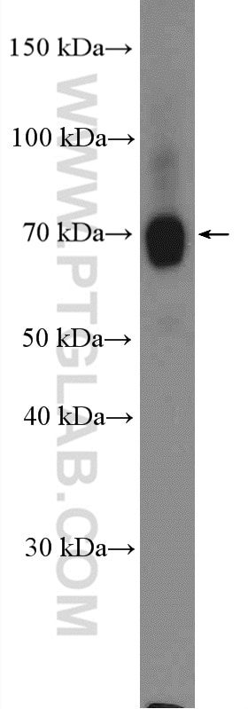 Western Blot (WB) analysis of pig kidney tissue using URAT1 Polyclonal antibody (14937-1-AP)