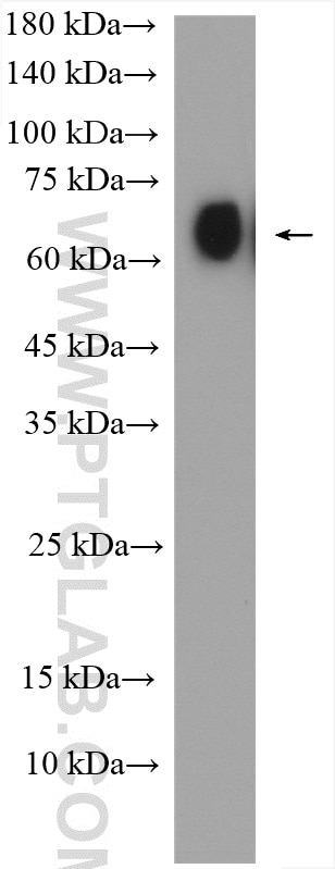 Western Blot (WB) analysis of human testis tissue using SLC22A14 Polyclonal antibody (17820-1-AP)