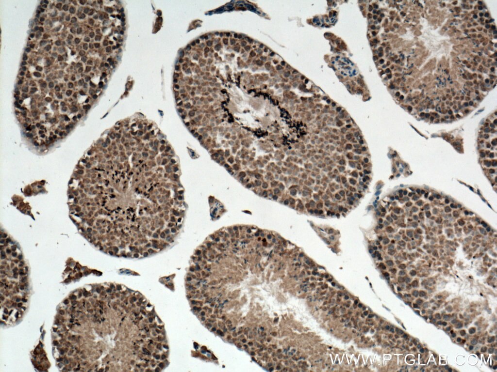 Immunohistochemistry (IHC) staining of mouse testis tissue using SLC22A14 Polyclonal antibody (28343-1-AP)