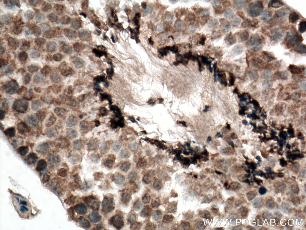 Immunohistochemistry (IHC) staining of mouse testis tissue using SLC22A14 Polyclonal antibody (28343-1-AP)