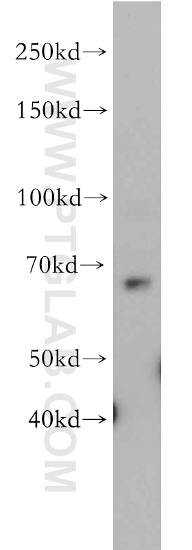 Western Blot (WB) analysis of A431 cells using SLC22A15 Polyclonal antibody (20626-1-AP)