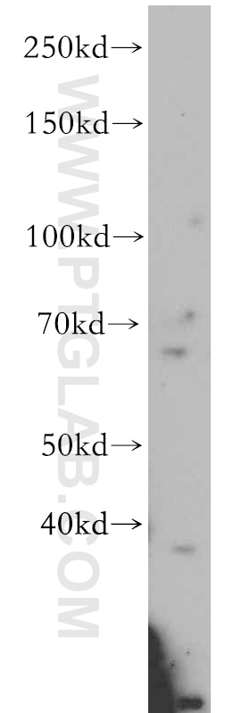 Western Blot (WB) analysis of human skeletal muscle tissue using SLC22A15 Polyclonal antibody (20626-1-AP)